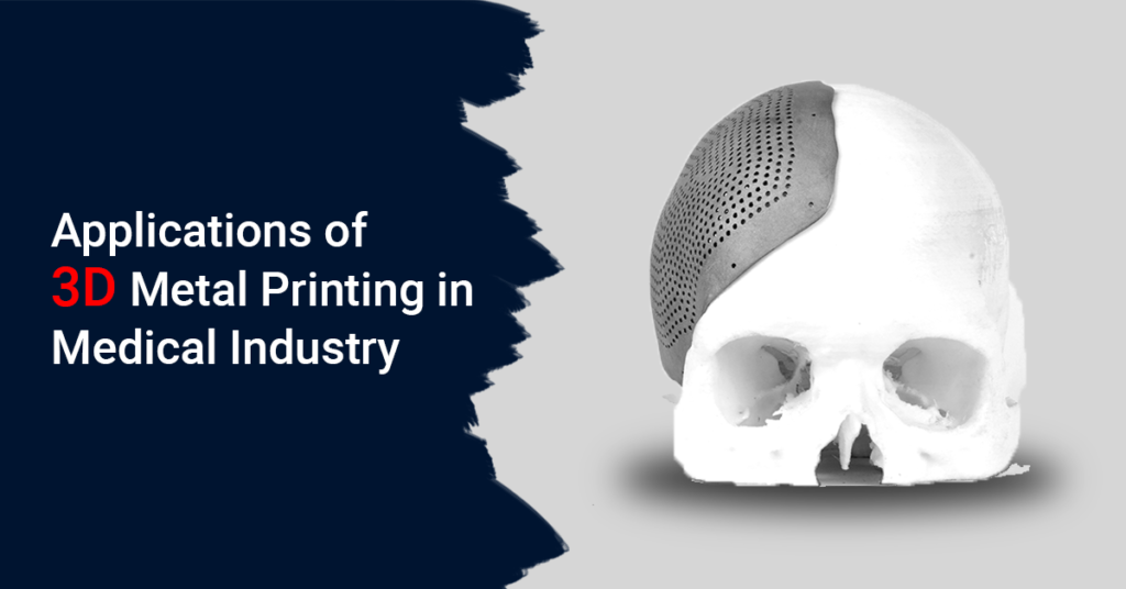 Applications of 3D Metal Printing in Medical Industry - 3D MeDical Post 1 Blog 1024x536