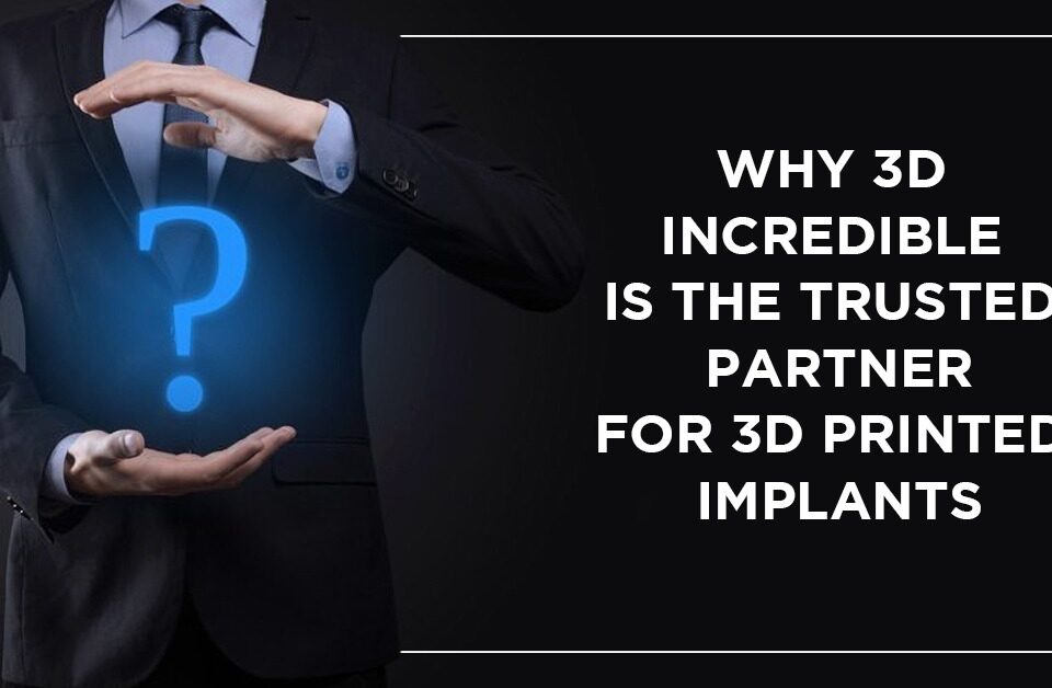 Why 3d Incredible Is the Trusted Partner for 3d Printed Implants