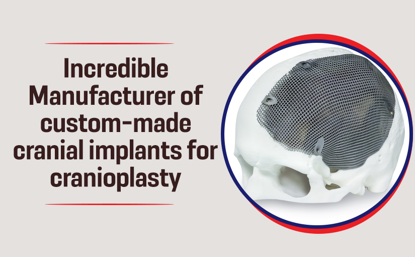 Incredible – Manufacturer of custom-made cranial implants for ...