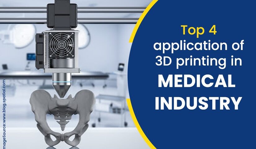 3d printing in the medical industry