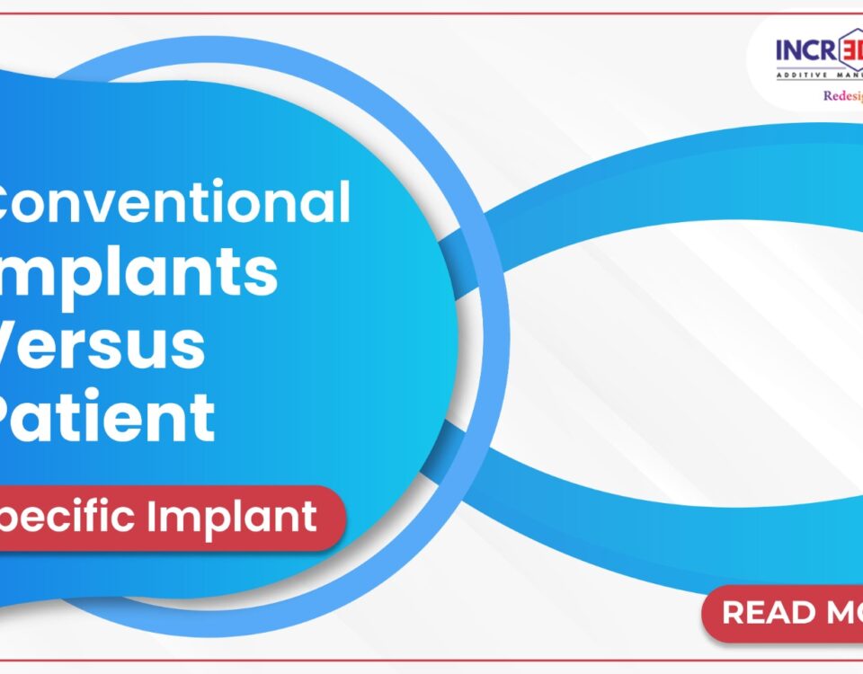 Conventional implants versus patient-specific implant