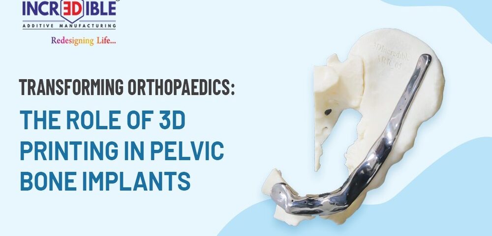 Transforming Orthopaedics The Role of 3D Printing in Pelvic Bone Implants