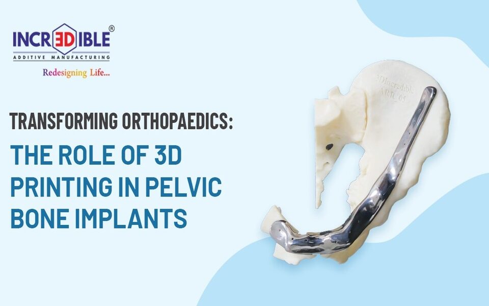 Transforming Orthopaedics The Role of 3D Printing in Pelvic Bone Implants