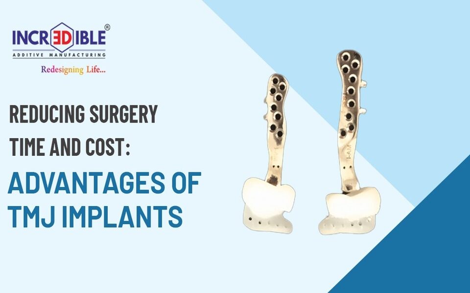 Reducing Surgery Time and Cost Advantages of TMJ implants