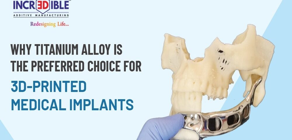 Why Titanium Alloy is the Preferred Choice for 3D-Printed Medical Implants