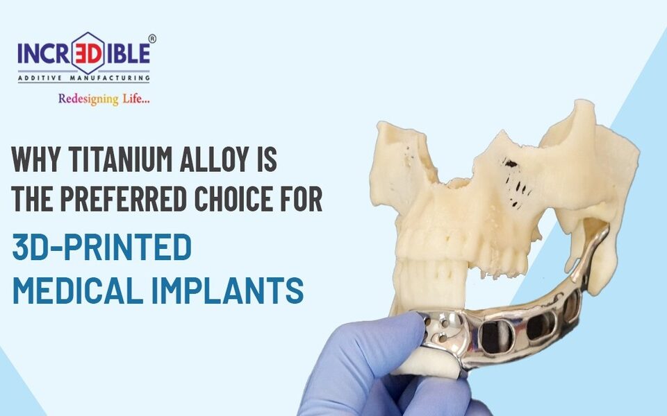 Why Titanium Alloy is the Preferred Choice for 3D-Printed Medical Implants