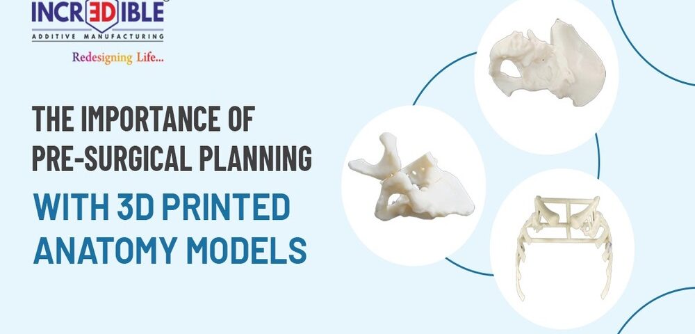 The Importance of Pre-Surgical Planning with 3D Printed Anatomy Models