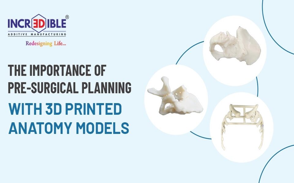 The Importance of Pre-Surgical Planning with 3D Printed Anatomy Models