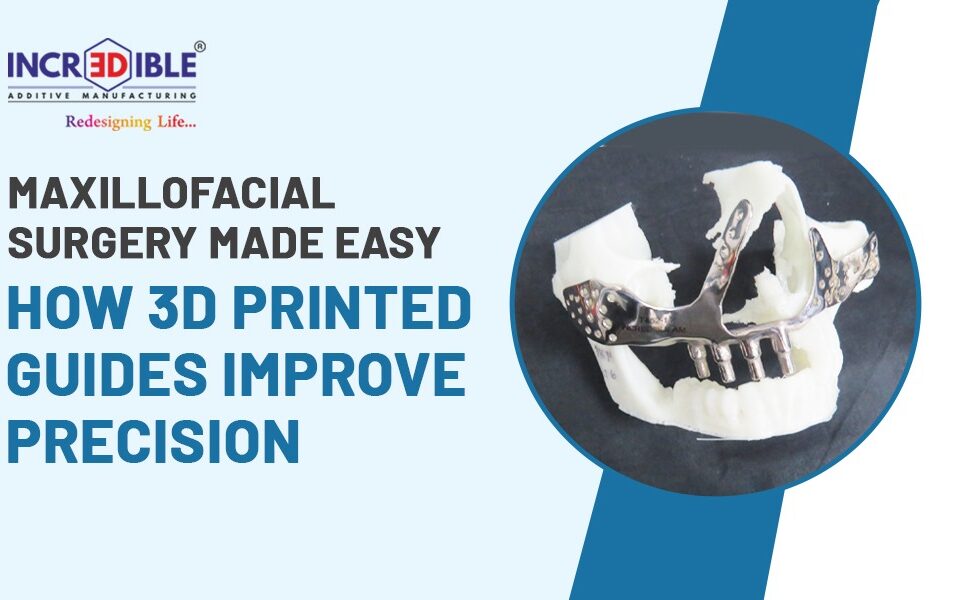 Maxillofacial Surgery Made Easy How 3D Printed Guides Improve Precision