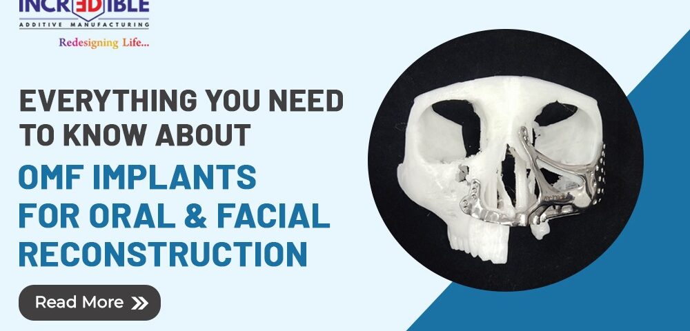 Everything You Need to Know About OMF Implants for Oral & Facial Reconstruction