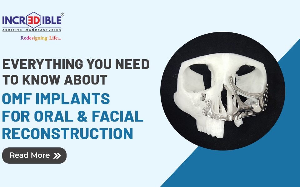 Everything You Need to Know About OMF Implants for Oral & Facial Reconstruction