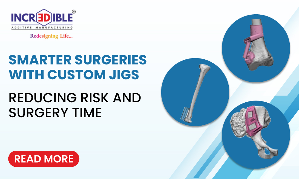 Smarter Surgeries with Custom Jigs: Reducing Risk and Surgery Time