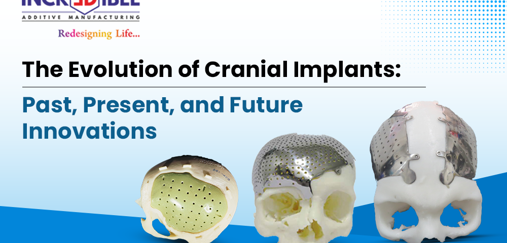 The Evolution of Cranial Implants Past, Present, and Future Innovations