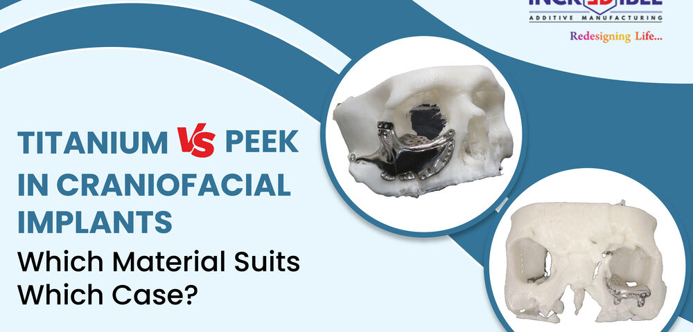 Titanium vs. PEEK in Craniofacial Implants: Which Material Suits Which Case?
