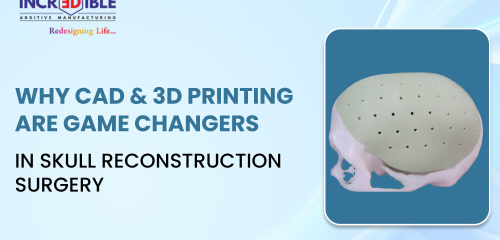 Why CAD and 3D Printing Are Game Changers in Skull Reconstruction Surgery