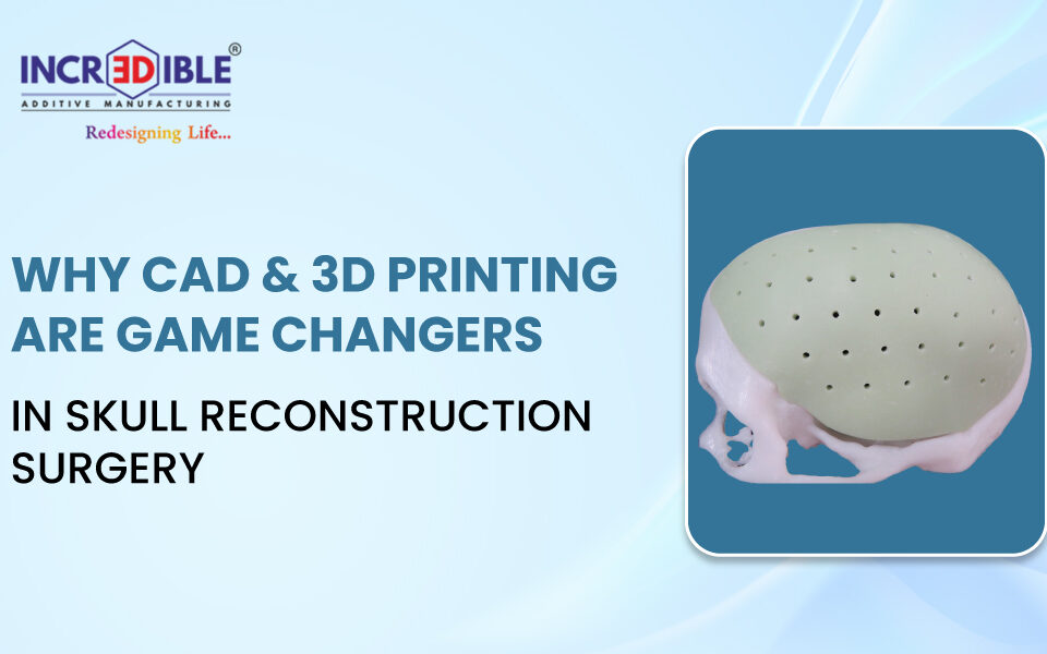 Why CAD and 3D Printing Are Game Changers in Skull Reconstruction Surgery