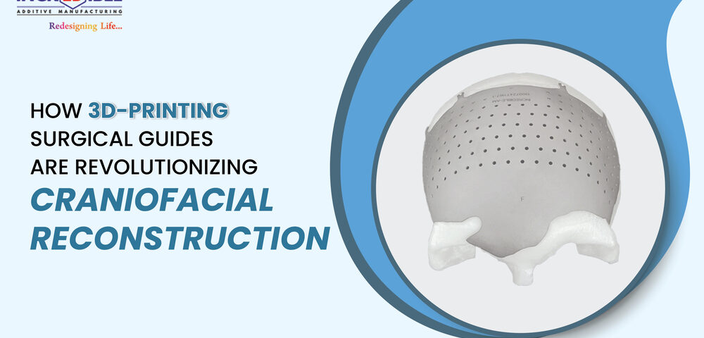 How 3D-Printed Surgical Guides Are Revolutionizing Craniofacial Reconstruction