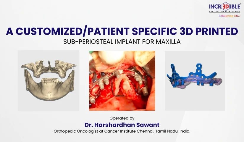 Maxilla Subperiostel