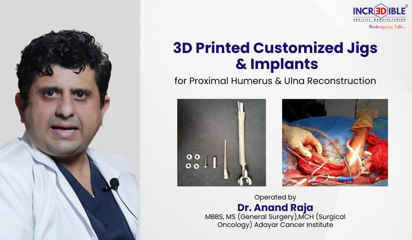 Limbsal Ortho Humerus   
