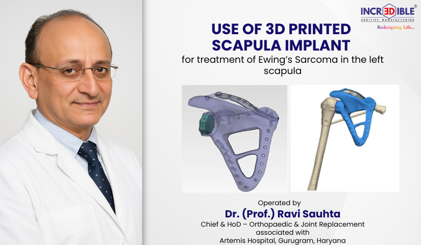 Limbsal Ortho Scapula    