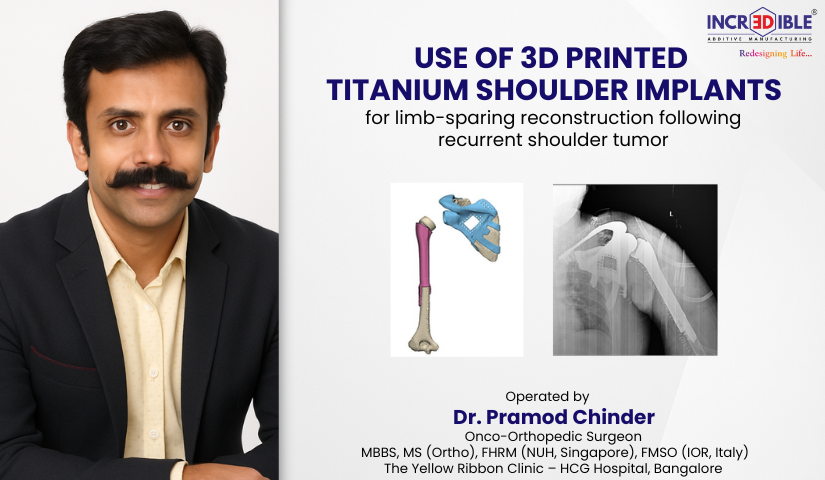 Limbsal Ortho Humerus   