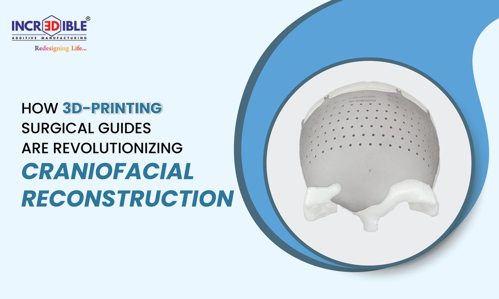 Orthopedic Innovations