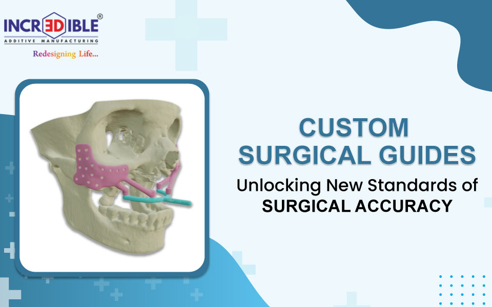 Custom Surgical Guides Unlocking New Standards of Surgical Accuracy