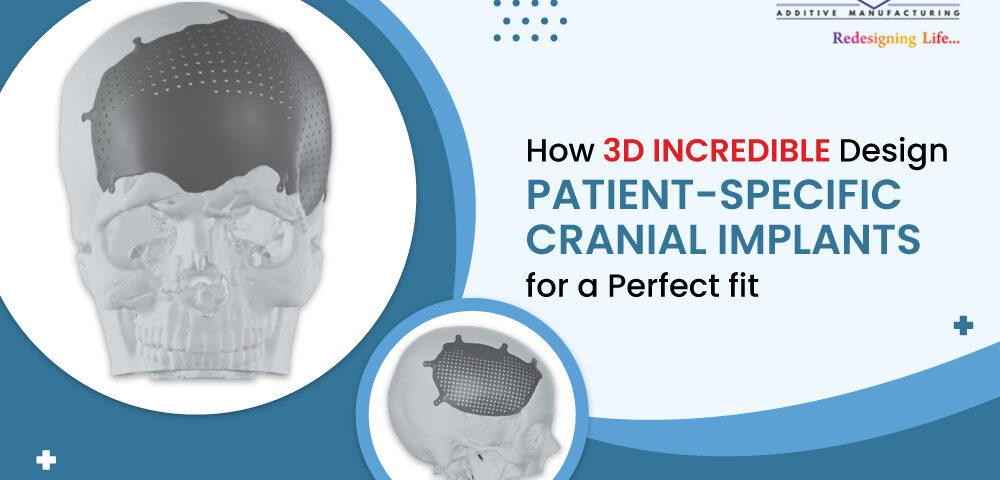 How 3D Incredible Designs Patient-Specific Cranial Implants for a Perfect Fit
