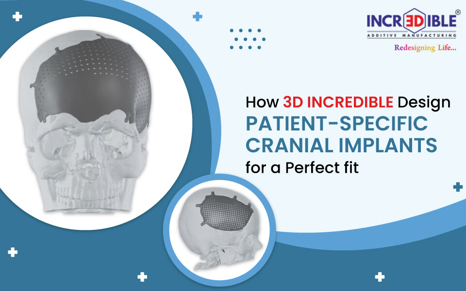 How 3D Incredible Designs Patient-Specific Cranial Implants for a Perfect Fit