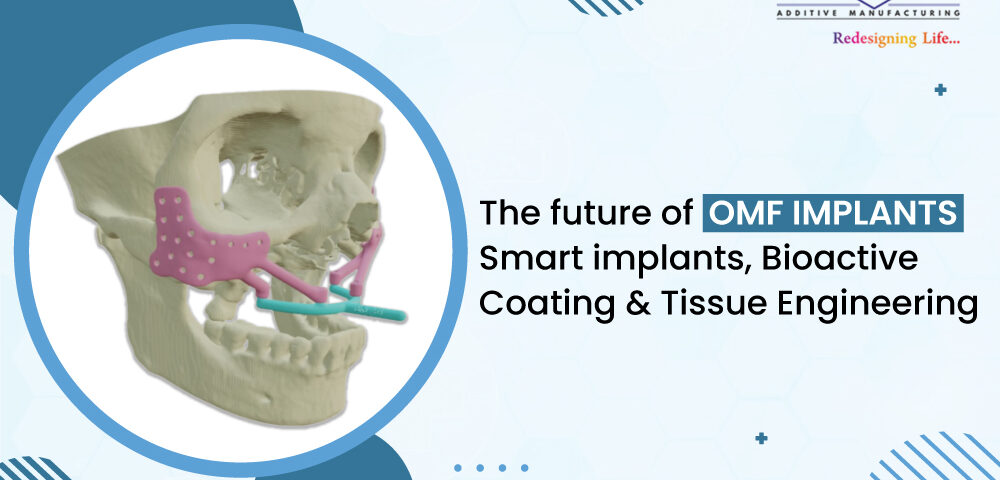 The Future of OMF Implants Smart Implants, Bioactive Coatings, & Tissue Engineering
