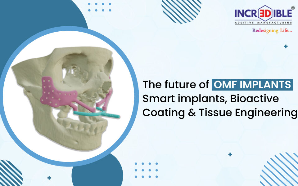 The Future of OMF Implants Smart Implants, Bioactive Coatings, & Tissue Engineering