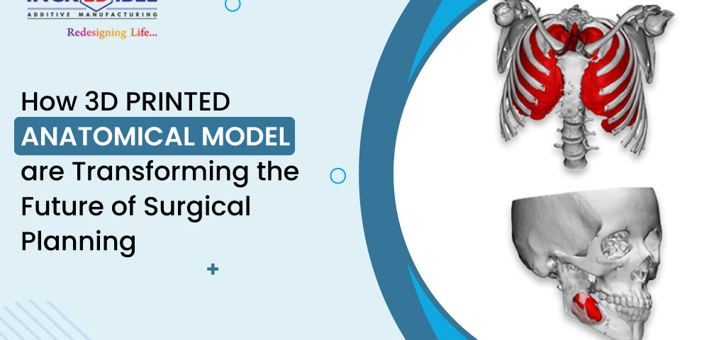 How 3D Printed Anatomical Models Are Transforming the Future of Surgical Planning