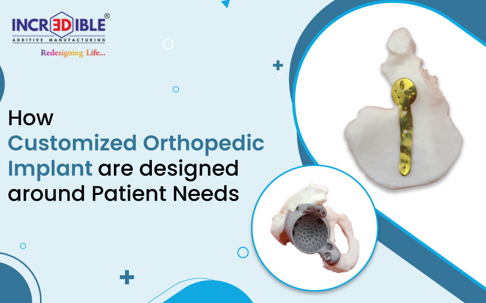 How Customized Orthopedic Implants Are Designed Around Patient Needs
