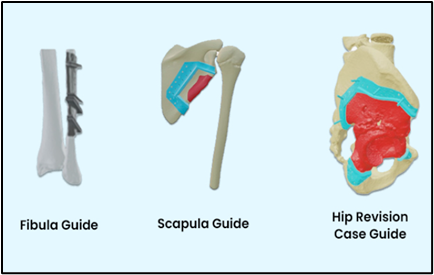 Orthopaedic Surgical Guides