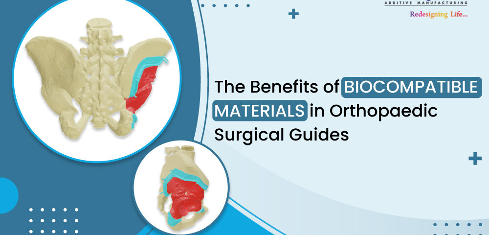 The Benefits of Biocompatible Materials in Orthopaedic Surgical Guides 