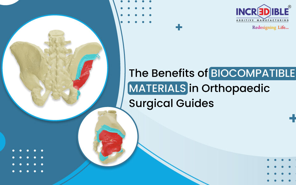 The Benefits of Biocompatible Materials in Orthopaedic Surgical Guides 