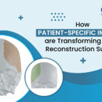 How Patient-Specific Implants Are Transforming Facial Reconstruction Surgery