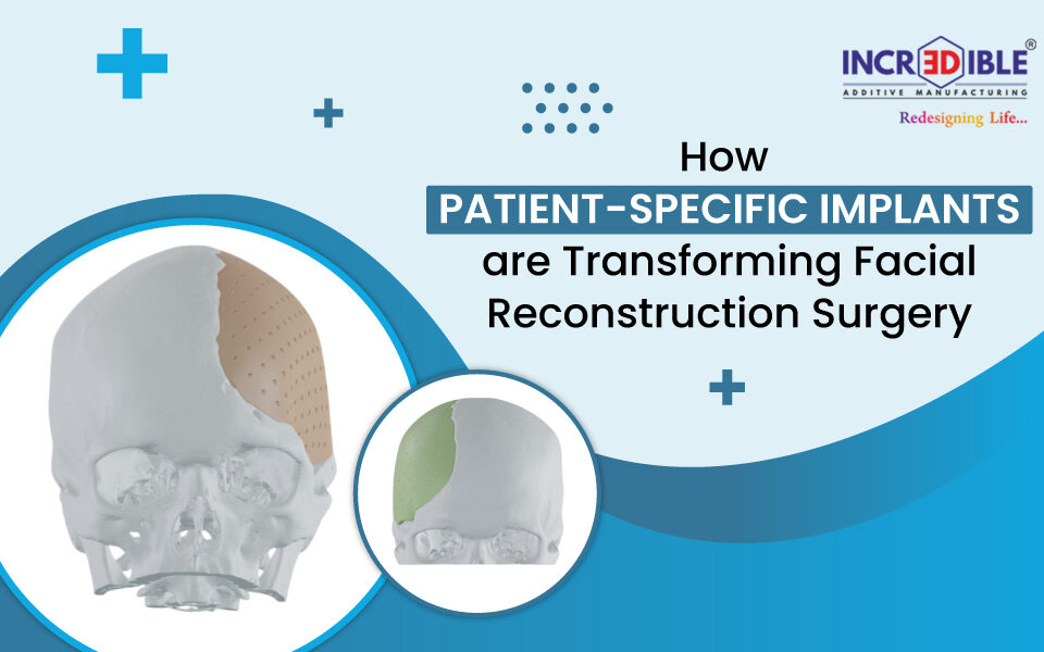 How Patient-Specific Implants Are Transforming Facial Reconstruction Surgery