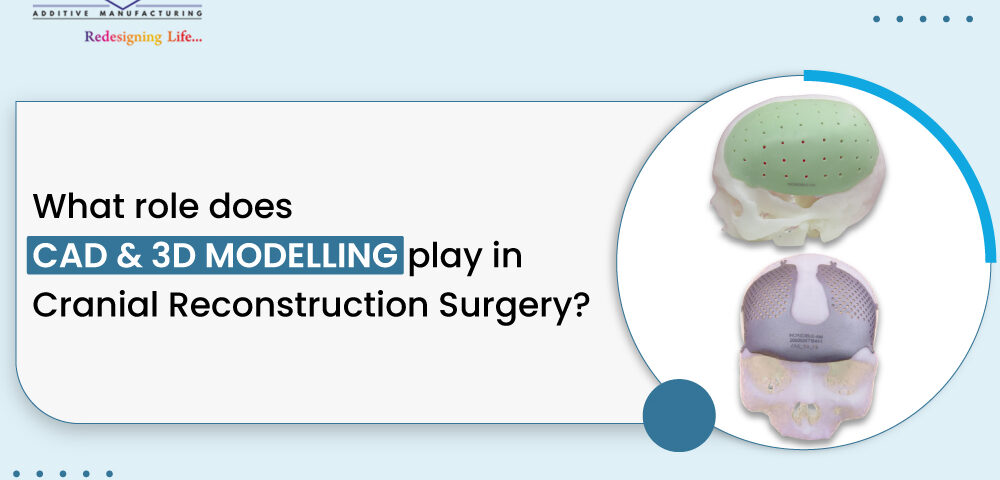 What Role Does CAD and 3D Modelling Play in Cranial Reconstruction Surgery
