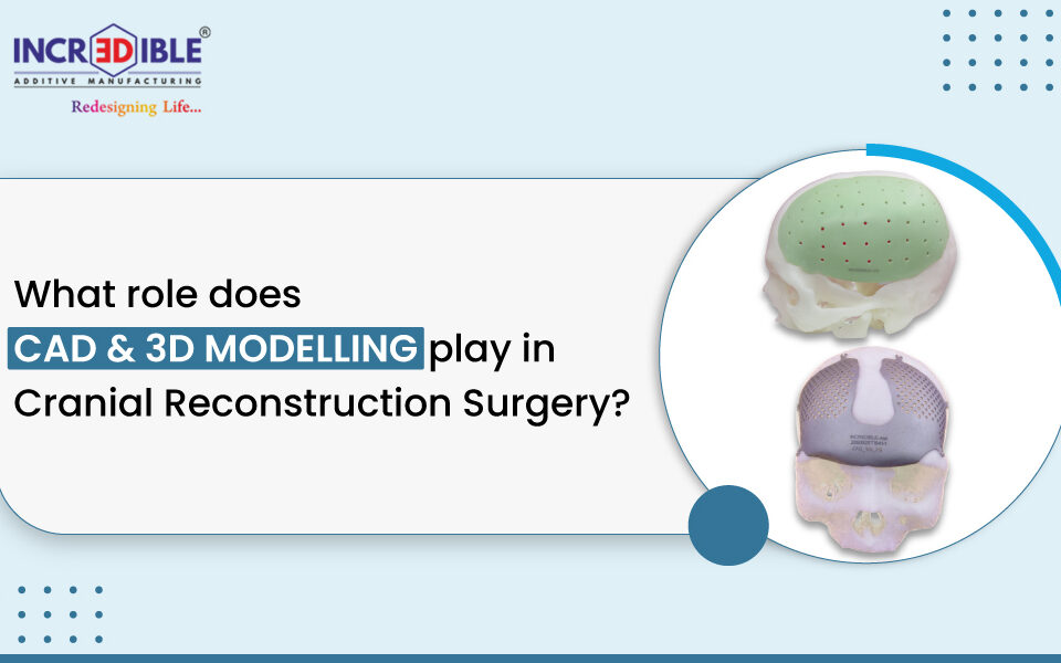 What Role Does CAD and 3D Modelling Play in Cranial Reconstruction Surgery