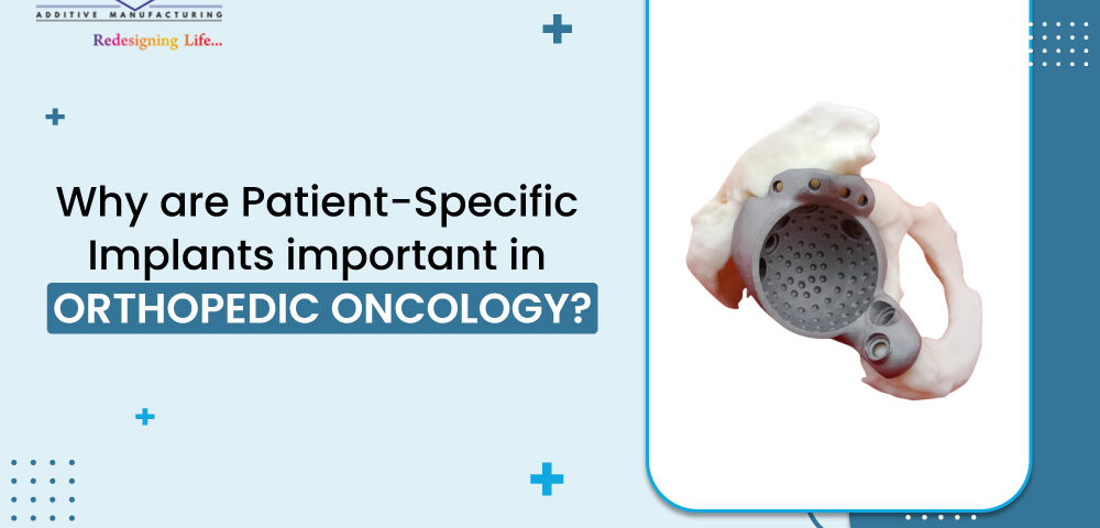 Why are patient-specific implants important in orthopedic oncology