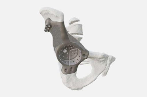 Improved Long-Term Operation and Recovery