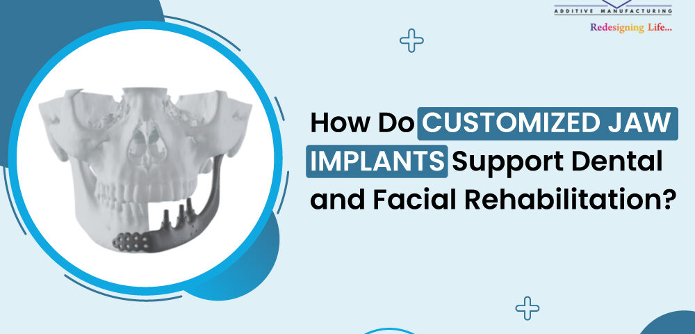 How Do Customized Jaw Implants Support Dental and Facial Rehabilitation