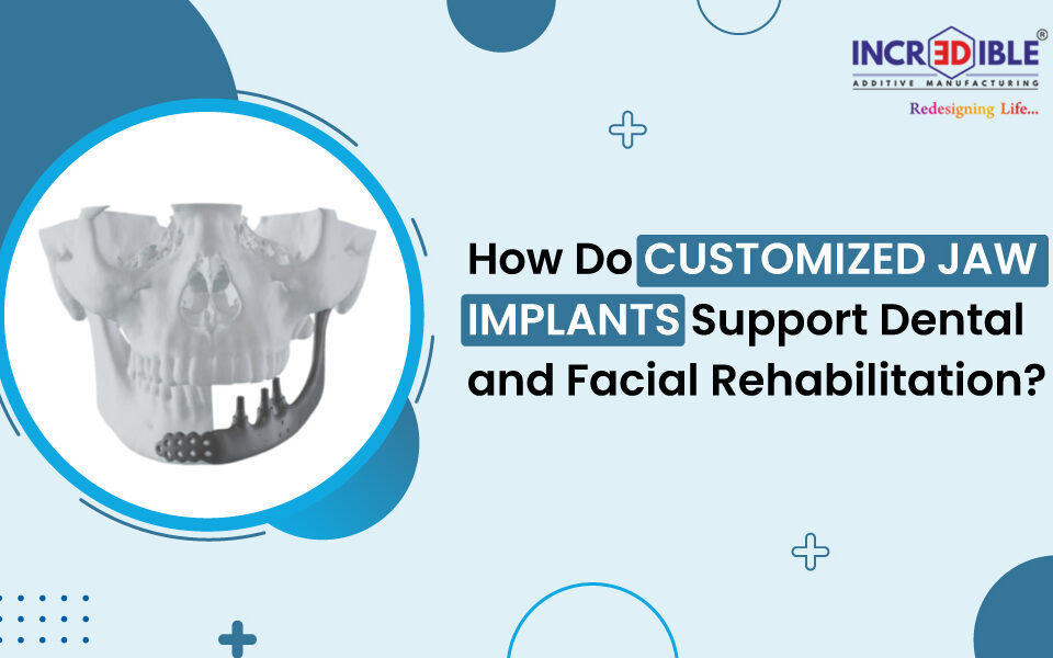 How Do Customized Jaw Implants Support Dental and Facial Rehabilitation