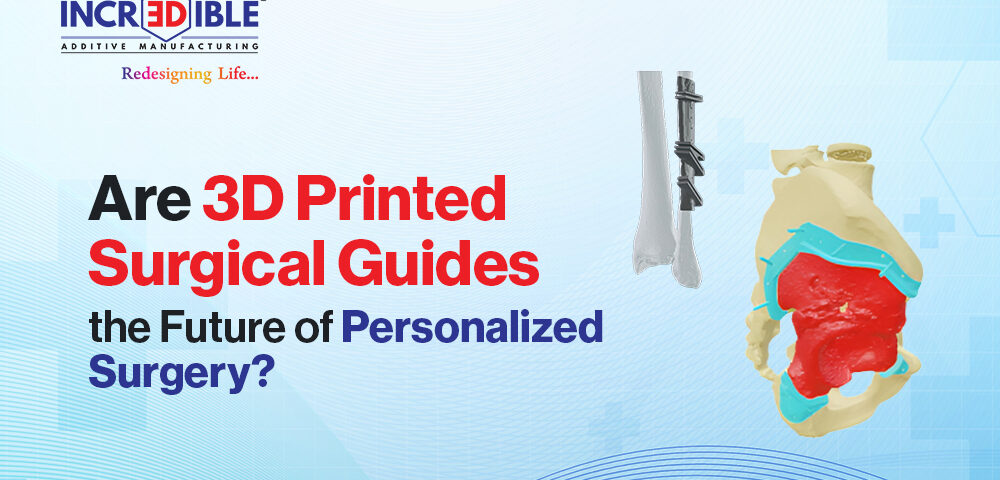 Are 3D Printed Surgical Guides the Future of Personalized Surgery