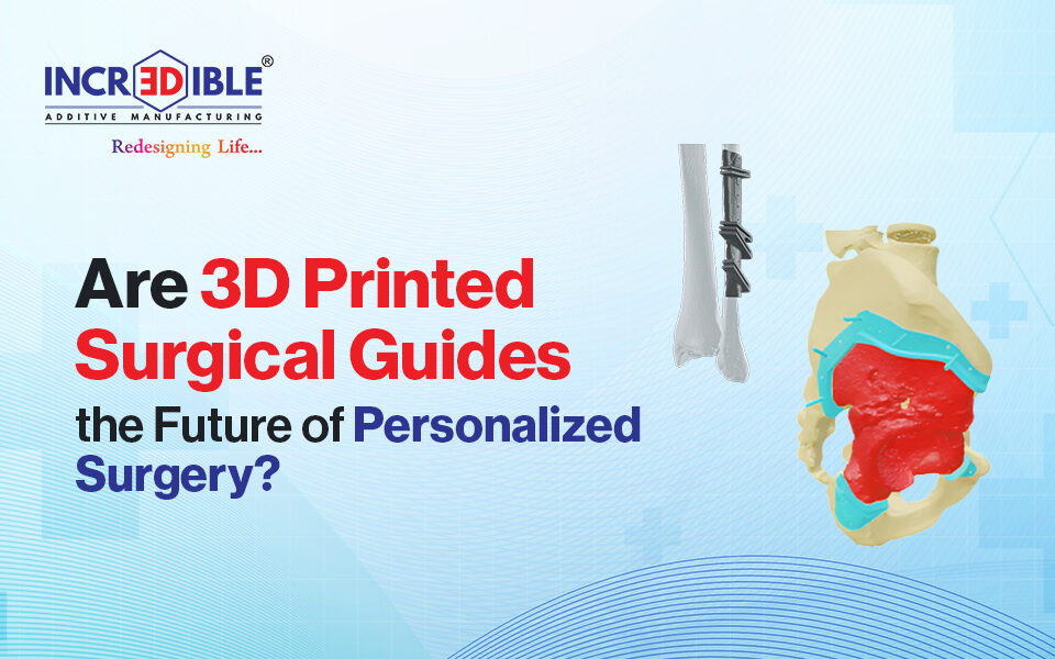 Are 3D Printed Surgical Guides the Future of Personalized Surgery