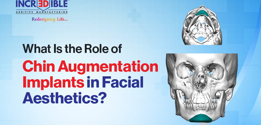 What Is the Role of Chin Augmentation Implants in Facial Aesthetics