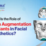 What Is the Role of Chin Augmentation Implants in Facial Aesthetics