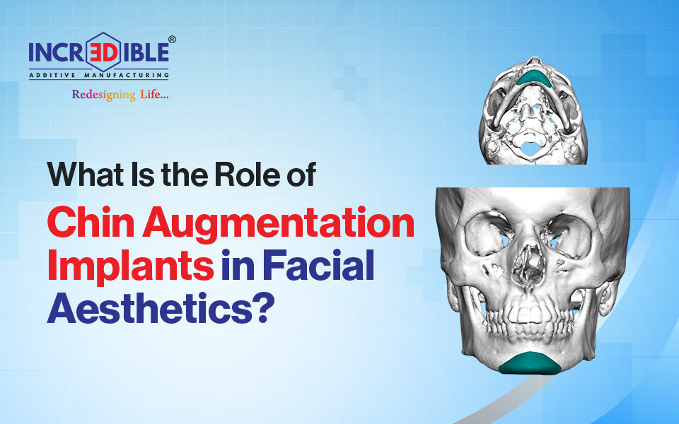 What Is the Role of Chin Augmentation Implants in Facial Aesthetics