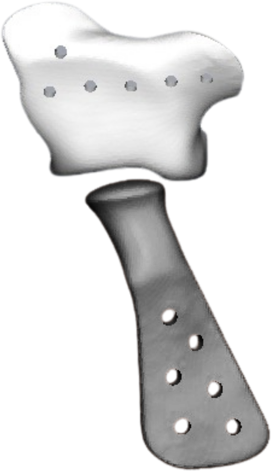 TMJ Implant